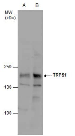 Invitrogen TRPS1 Polyclonal Antibody 100 &mu;L | Buy Online | Invitrogen&trade; | Fisher Scientific