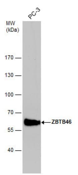 Invitrogen ZBTB46 Polyclonal Antibody 100 &mu;L; Unconjugated:Antibodies,