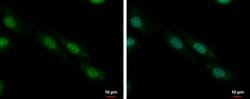 Invitrogen ZFP82 Polyclonal Antibody 100 &mu;L; Unconjugated:Antibodies,