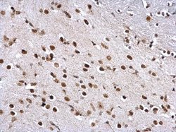 Invitrogen ZFP82 Polyclonal Antibody 100 &mu;L; Unconjugated:Antibodies,