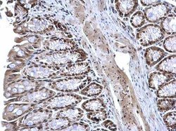 Invitrogen ZFP82 Polyclonal Antibody 100 &mu;L; Unconjugated:Antibodies,