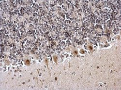 Invitrogen ZFP82 Polyclonal Antibody 100 &mu;L; Unconjugated:Antibodies,