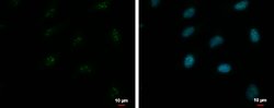 Invitrogen ZNF556 Polyclonal Antibody 100 &mu;L; Unconjugated:Antibodies,