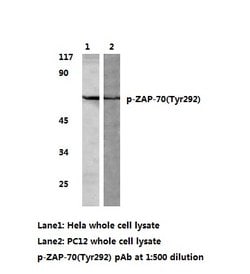 Invitrogen Phospho-Zap-70 (Tyr292) Polyclonal Antibody 100 &mu;L | Buy Online | Invitrogen&trade; | Fisher Scientific