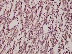 Invitrogen JNK1/JNK2/JNK3 Polyclonal Antibody 100 &mu;L; Unconjugated:Antibodies,