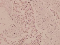 Invitrogen AMPK alpha-1,2 Polyclonal Antibody 100 &mu;L; Unconjugated:Antibodies,
