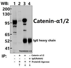 Invitrogen alpha Catenin Polyclonal Antibody 100 μL; Unconjugated:Antibodies,