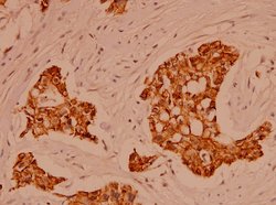 Invitrogen alpha Catenin Polyclonal Antibody 100 μL; Unconjugated:Antibodies,