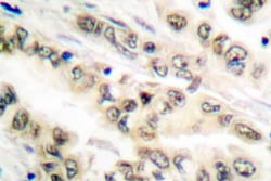 Invitrogen E2F4/E2F5 Polyclonal Antibody 100 &mu;L; Unconjugated:Antibodies,