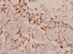 Invitrogen LIMK1/LIMK2 Polyclonal Antibody 100 &mu;L; Unconjugated:Antibodies,