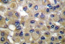 Invitrogen Mammaglobin B Polyclonal Antibody 100 &mu;L | Buy Online | Invitrogen&trade; | Fisher Scientific