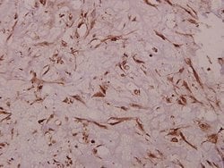 Invitrogen&trade;&nbsp;Sodium Channel Pan Polyclonal Antibody
