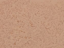 Invitrogen FOXO1/FOXO3/FOXO4 Polyclonal Antibody 100 &mu;L; Unconjugated:Antibodies,