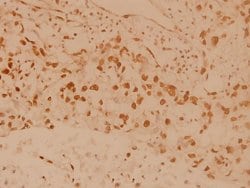 Invitrogen MSK1 Polyclonal Antibody 100 &mu;L; Unconjugated:Antibodies,