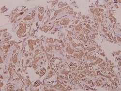 LZK Polyclonal Antibody, Invitrogen 100 &mu;L; Unconjugated:Antibodies,