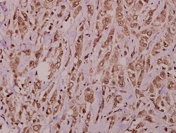 Invitrogen AKAP10 Polyclonal Antibody 100 &mu;L; Unconjugated:Antibodies,