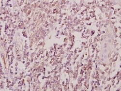 Invitrogen ZRANB2 Polyclonal Antibody 100 &mu;L | Buy Online | Invitrogen&trade; | Fisher Scientific