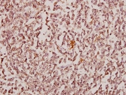 CBX6 Polyclonal Antibody:Antibodies, Polyclonal