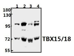 Invitrogen TBX15/TBX18 Polyclonal Antibody 100 &mu;L | Buy Online | Invitrogen&trade; | Fisher Scientific