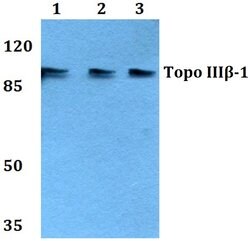 Invitrogen TOP3B Polyclonal Antibody 100 &mu;L; Unconjugated:Antibodies,