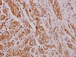 Invitrogen HEXB Polyclonal Antibody 100 &mu;L; Unconjugated:Antibodies,