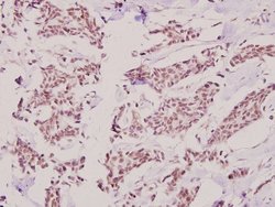 Invitrogen HKR1 Polyclonal Antibody 100 &mu;L; Unconjugated:Antibodies,