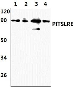 Invitrogen CDK11B Polyclonal Antibody 100 &mu;L; Unconjugated:Antibodies,