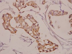 Invitrogen AKAP5 Polyclonal Antibody 100 μL; Unconjugated:Antibodies,