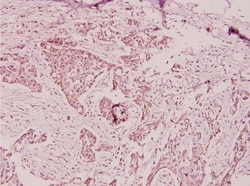 Invitrogen PTX3 Polyclonal Antibody 100 &mu;L; Unconjugated:Antibodies,