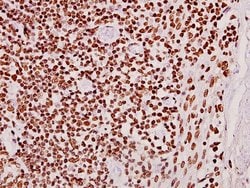 Invitrogen CLK2 Polyclonal Antibody 100 &mu;L; Unconjugated:Antibodies,