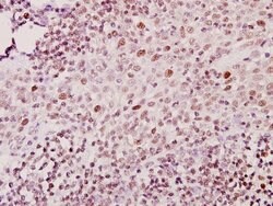 Invitrogen ZNF75D Polyclonal Antibody 100 &mu;L; Unconjugated:Antibodies,