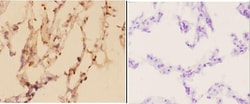 Invitrogen ADARB1 Polyclonal Antibody 100 &mu;L; Unconjugated:Antibodies,