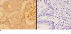 Invitrogen ADARB1 Polyclonal Antibody 100 &mu;L; Unconjugated:Antibodies,