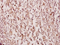 TUSC3 Polyclonal Antibody:Anticuerpos