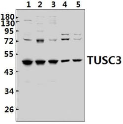 TUSC3 Polyclonal Antibody:Anticuerpos