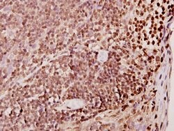Invitrogen TDE1 Polyclonal Antibody 100 &mu;L; Unconjugated:Antibodies,