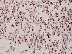 Invitrogen ZNF174 Polyclonal Antibody 100 &mu;L; Unconjugated:Antibodies,