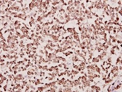 Invitrogen TAF6L Polyclonal Antibody 100 &mu;L; Unconjugated:Antibodies,