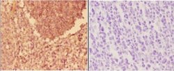Invitrogen alpha Actinin 3 Polyclonal Antibody 100 &mu;L; Unconjugated:Antibodies,