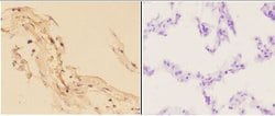 Invitrogen alpha Actinin 3 Polyclonal Antibody 100 &mu;L; Unconjugated:Antibodies,