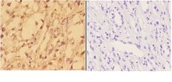Invitrogen alpha Actinin 3 Polyclonal Antibody 100 &mu;L; Unconjugated:Antibodies,