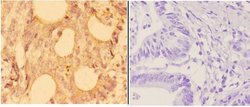 Invitrogen alpha Actinin 3 Polyclonal Antibody 100 &mu;L; Unconjugated:Antibodies,