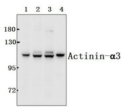 Invitrogen alpha Actinin 3 Polyclonal Antibody 100 &mu;L; Unconjugated:Antibodies,