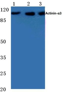 Invitrogen alpha Actinin 3 Polyclonal Antibody 100 &mu;L; Unconjugated:Antibodies,