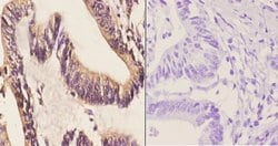 Invitrogen CABLES1 Polyclonal Antibody 100 &mu;L; Unconjugated:Antibodies,