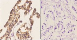 Invitrogen CABLES1 Polyclonal Antibody 100 &mu;L; Unconjugated:Antibodies,