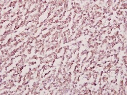 Invitrogen H-cadherin Polyclonal Antibody 100 &mu;L; Unconjugated:Antibodies,