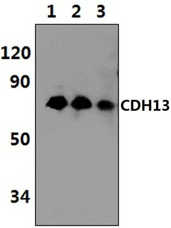 Invitrogen H-cadherin Polyclonal Antibody 100 &mu;L; Unconjugated:Antibodies,
