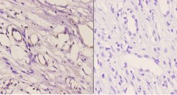 Invitrogen CDH16 Polyclonal Antibody 100 &mu;L | Buy Online | Invitrogen&trade; | Fisher Scientific