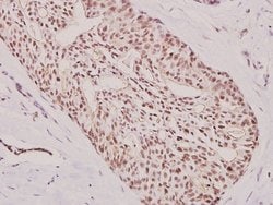 Invitrogen&trade;&nbsp;ATF3 Polyclonal Antibody